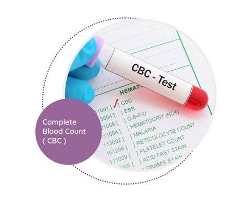 Understanding Lab Tests I: Complete Blood Count and Blood .